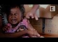 CAMPAGNE DE VACCINATION MASSIVE CONTRE LA ROUGEOLE