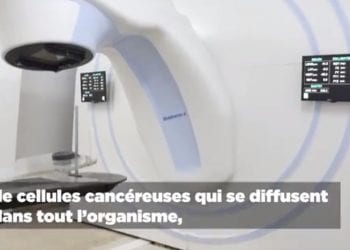 TRAITEMENT DU CANCER – La radiothérapie, comment ça marche ?