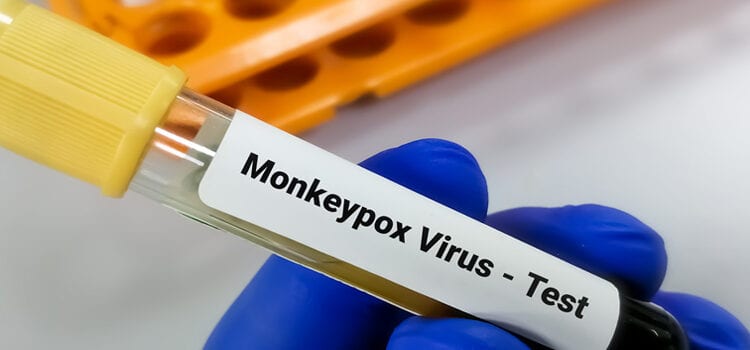 SANTE – L’OMS déclenche son plus haut niveau d’alerte mondiale face au virus Mpox ou la variole du singe