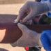 EPIDÉMIE – Deux nouveaux décès liés à la Mpox et une centaine de guérisons en trois jours